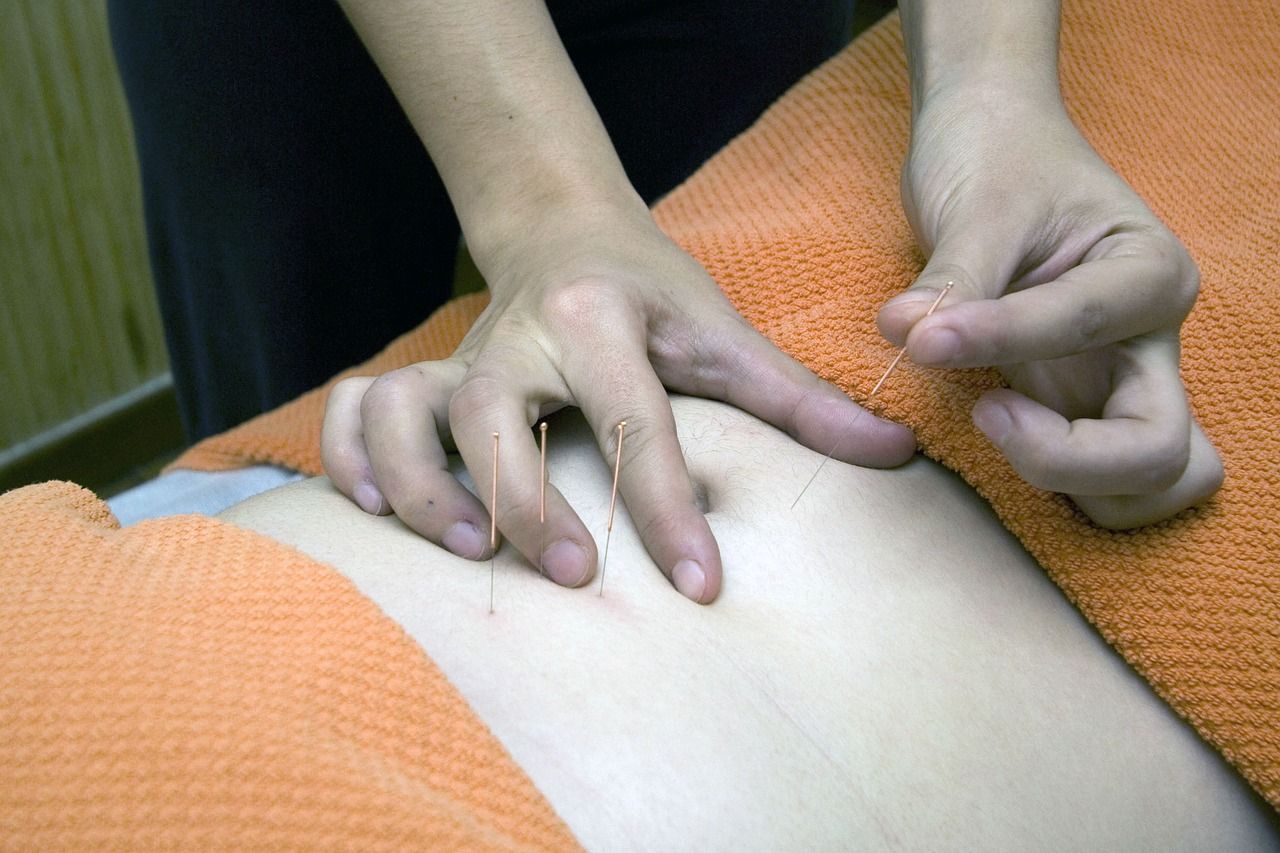 Acupuntura Bilbao sección servicios